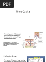 Tinea Capitis