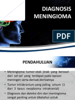 Meningioma