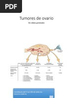 Tumores de Ovario