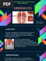 Amigdalitis Expo.