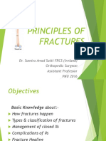 Principles of Fractures