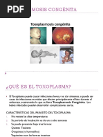 Toxoplasmosis Congénita