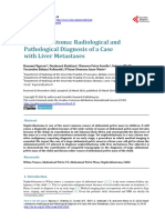 Nephroblastoma: Radiological and Pathological Diagnosis of A Case With Liver Metastases