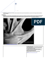 Scaphoid Radiography - WikiRadiography