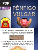 Pénfigo Vulgar