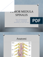 Tumor Medula Spinalis