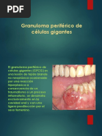 Granuloma Periférico de Células Gigantes