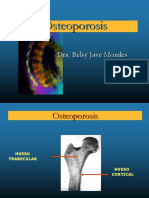 Osteoporosis