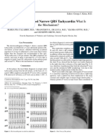 Salbutamol-Induced Narrow QRS Tachycardia: What Is: The Mechanism?