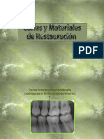 Caries y Materiales de Restauración