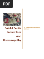 Painful Penile Induration and Homoeopathy