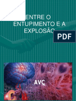 Avc Isquêmico e Hemorrágico - 0603