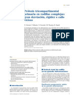 04 - Prótesis Tricompartimental Primaria en Rodillas Complejas Gran Desviación, Rigidez o Callo Vicioso