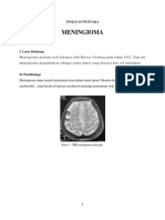 MENINGIOMAA