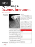 Fractured Instrument: Bypassing A