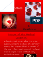 Heart Attack: by Chris Mclaren