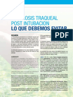 Estenosis Traqueal Post Intubacion Lo Que Debemos Evitar PDF