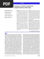 Pinter Et Al. (2001) Neuroanatomy of Down's Syndrome. A High-Resolution MRI Study PDF