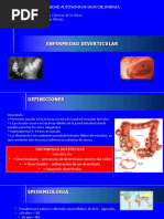 Enfermedad Diverticular