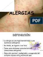 Alergias