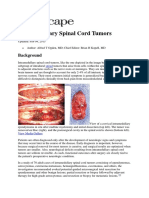 Intramedullary Spinal Cord Tumors