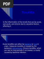 Tonsillitis