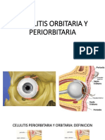 Celulitis Orbitaria y Periorbitaria