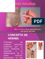 Hernia Inguinal