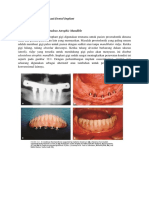 Indikasi Dan Kontraindikasi Dental Implan