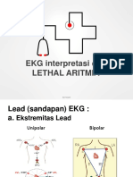 EKG Interpretasi Dan Lethal Aritmia: Aan Nuraeni