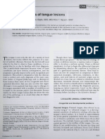 Differential Diagnosis of Tongue Lesions