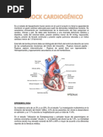 Shock Cardiogenico