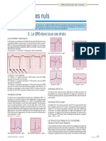 ECG Pour Les Nuls Partie 3