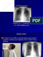 Plain Chest X Ray