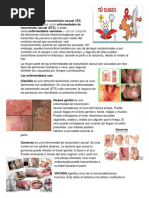 Enfermedades de Transmision Sexual Ima