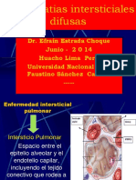 Neumopatías Intersticiales Difusas