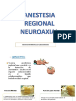 Anestesia Regional