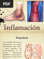 Inflamación Inmuno