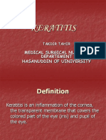 Keratitis