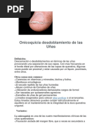 Onicoquicia Desdoblamiento de Las Uñas