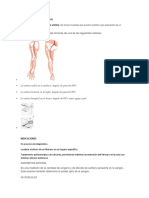 Técnica Via Intraarterial