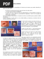 CA de Cuello Uterino. DR Marcano