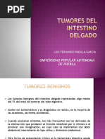 Tumores Del Intestino Delgado