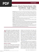 Masseter Muscle Reattachment After Mandibular Angle Surgery