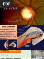 Glaucoma 