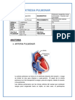 Atresia Pulmonar