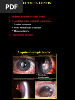 Acquired 2. Isolated Familial Ectopia Lentis 3. Associated With Systemic Syndromes