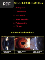 Primary Angle-Closure Glaucoma: 1. Pathogenesis 2. Classification