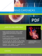 Arritmias Cardiacas 1