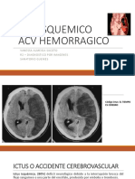 Acv Isquemico Vs Hemorragico